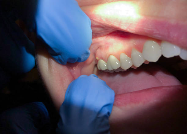 Best Pediatric Emergency Dentist in Sherman, TX